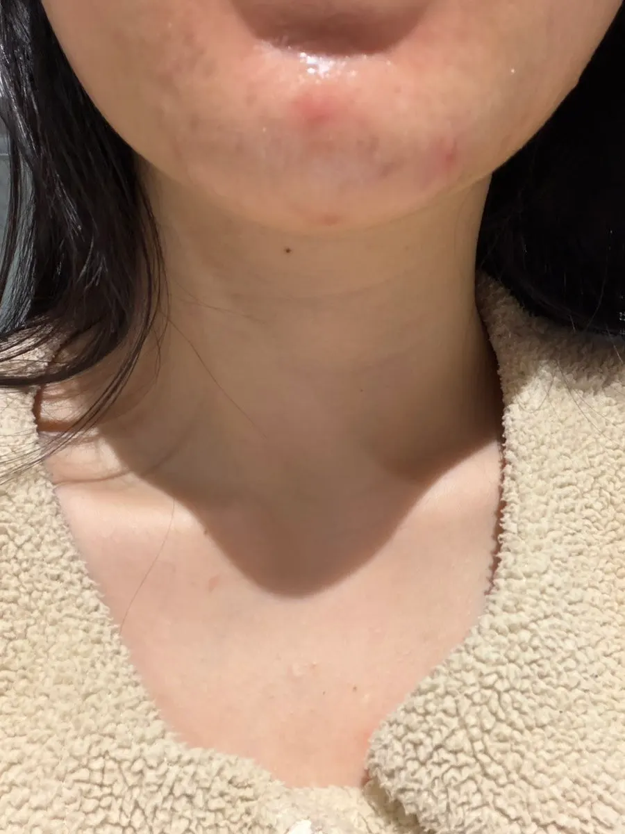 피부 톤 변화 경험 관련 이미지