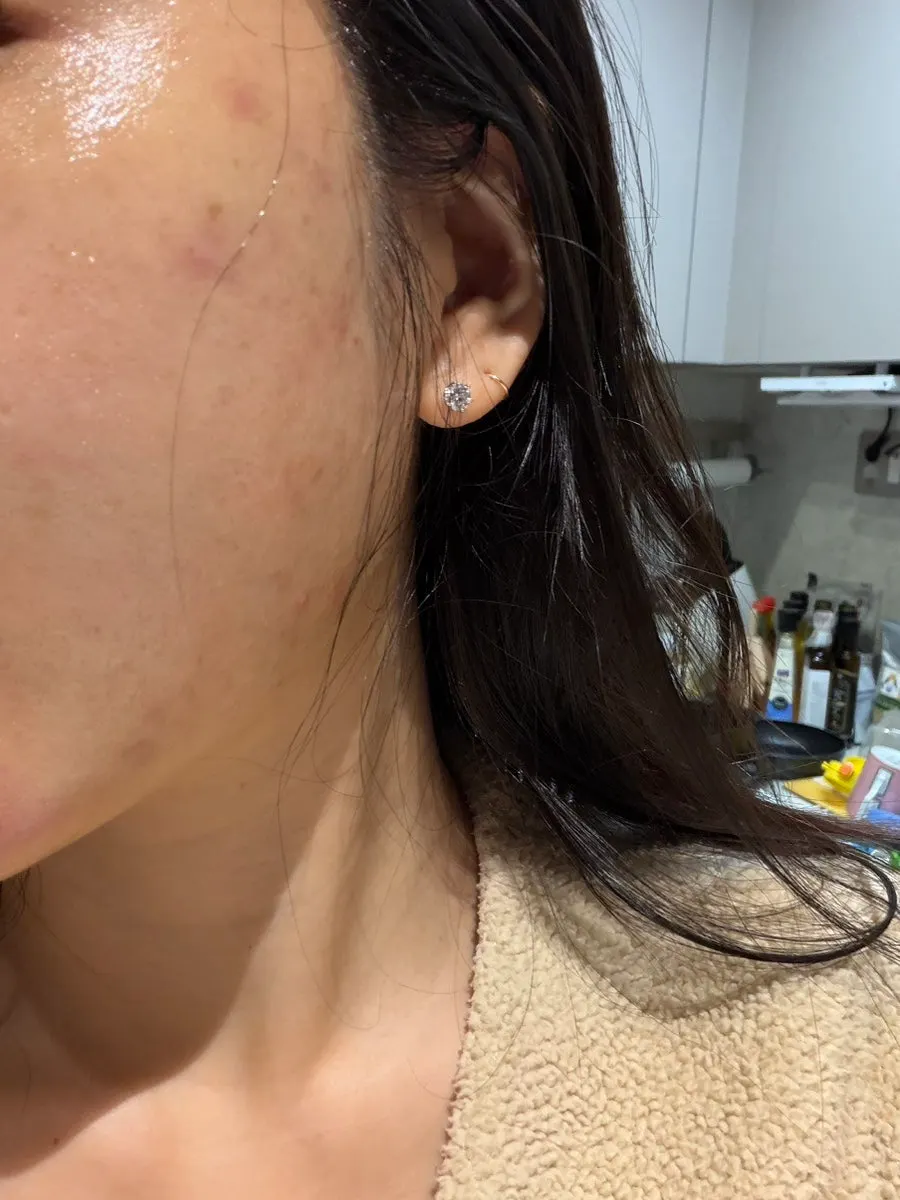 크림 사용 중 피부 변화 관련 이미지