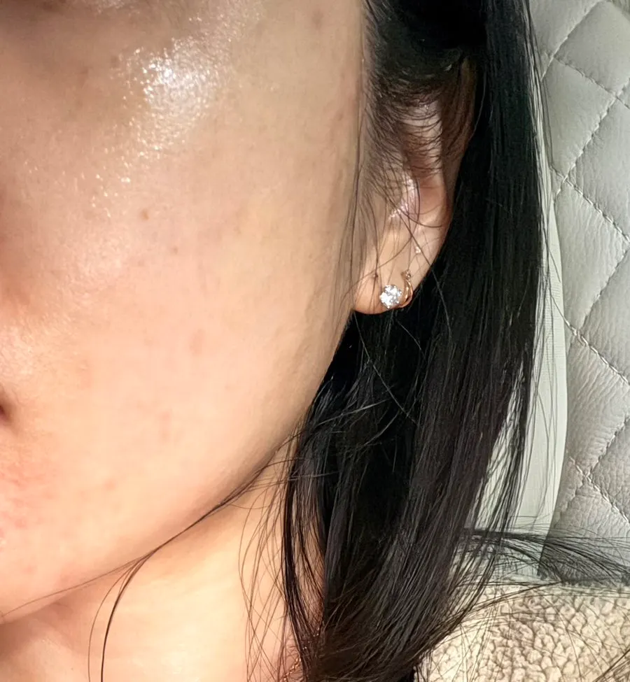 Photo documenting skin condition after using the cream