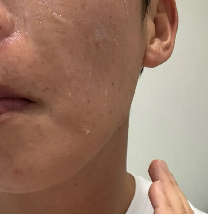 올그린톡스 솔루션크림 제품 설명 이미지