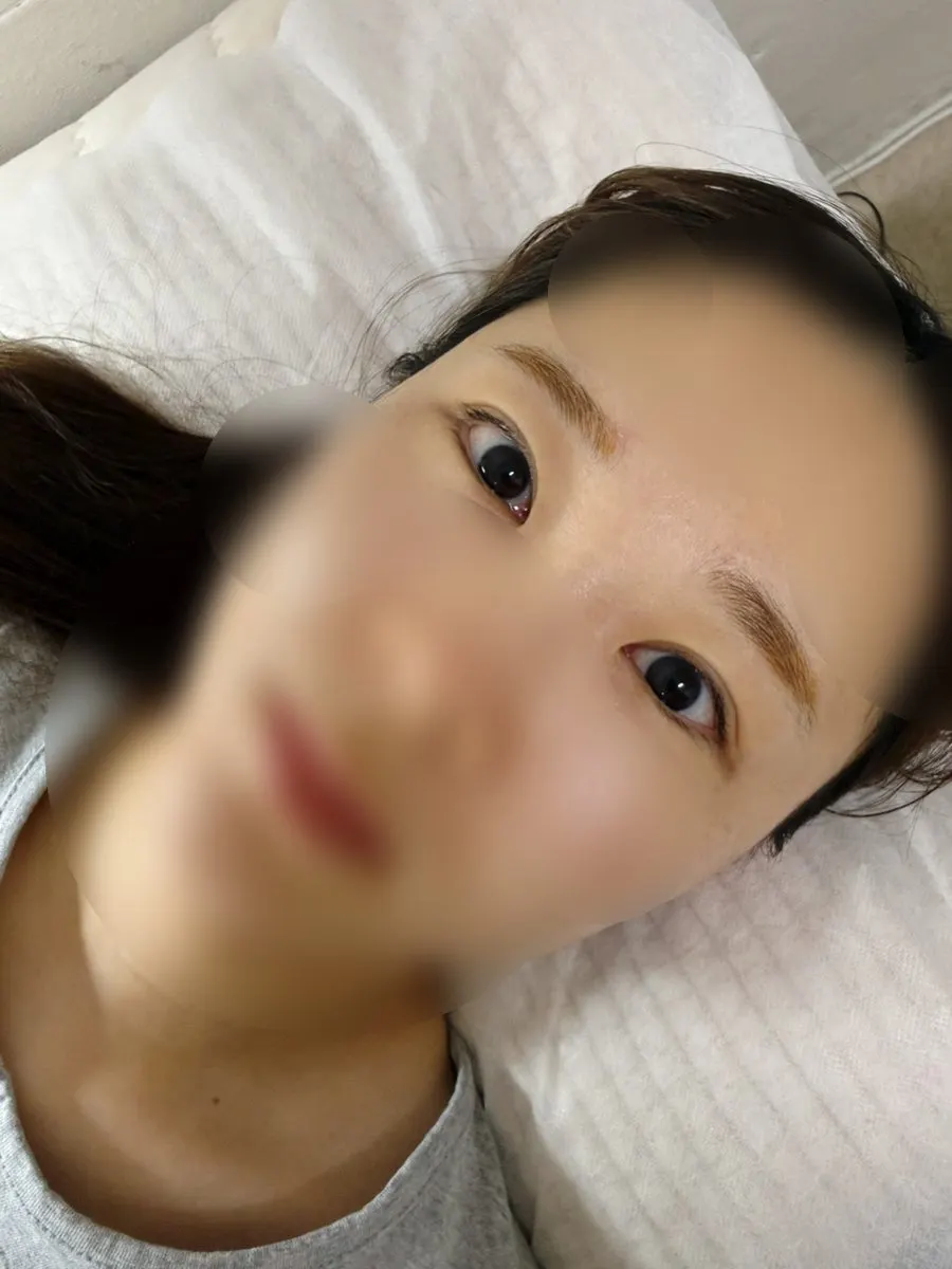 Lash extension treatment with fixing patches applied