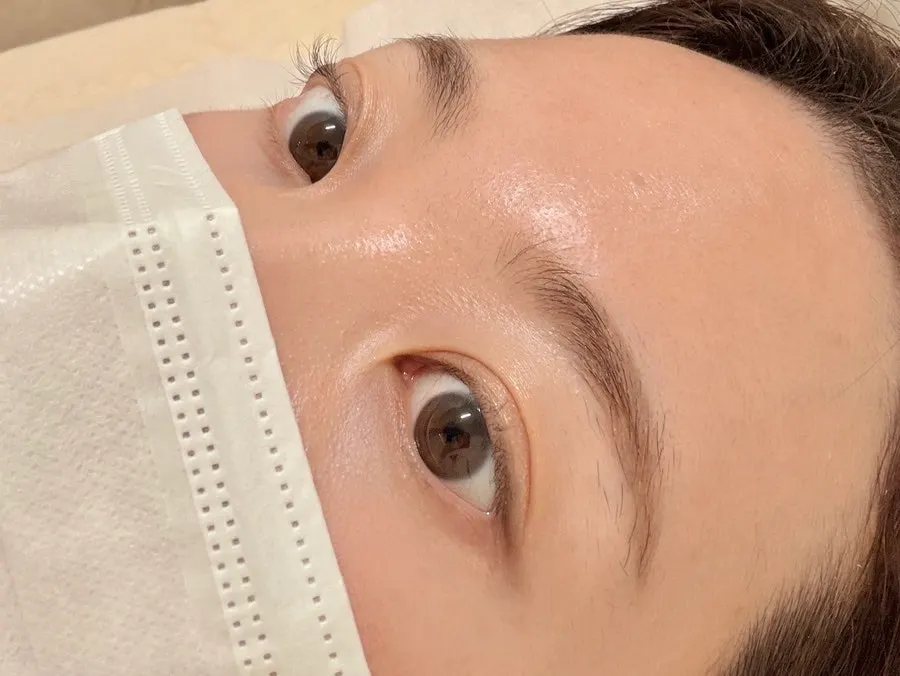 곱슬기 있는 속눈썹 시술 전 모습
