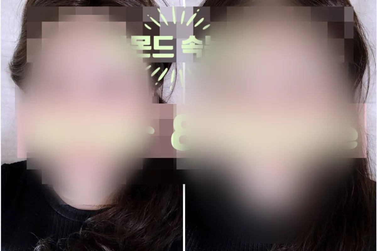 Before and after comparison of the eyes with lash extensions