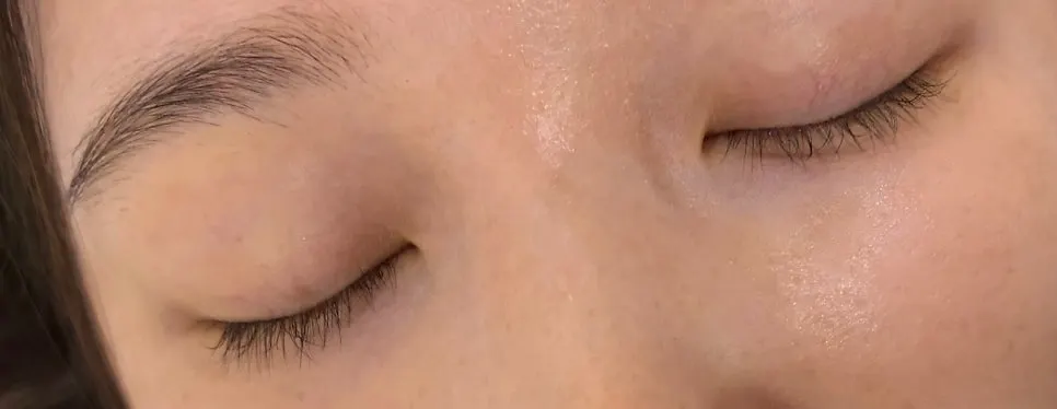 Close-up of lashes two months after treatment, before shot