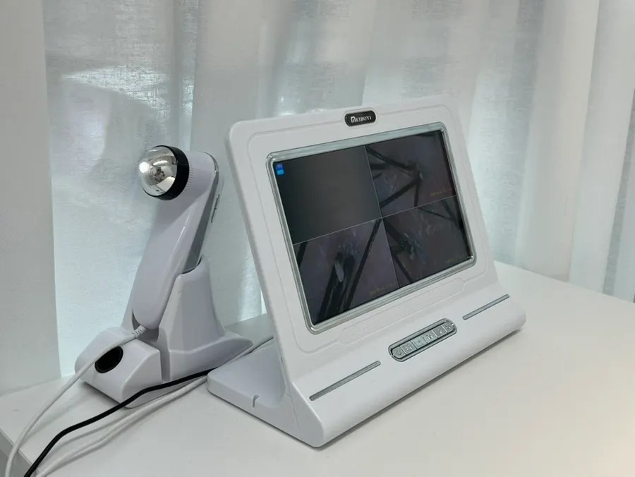 Magnified scalp screen captured with scope equipment