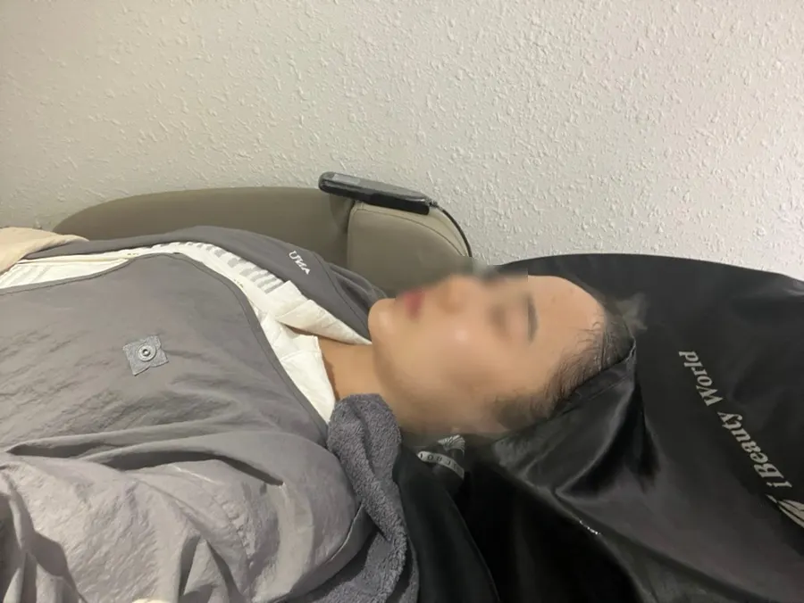 Preparations for the scalp care treatment