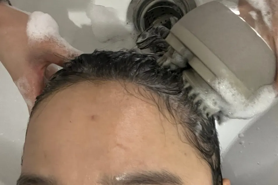 Dedicated machine removing scalp flaking