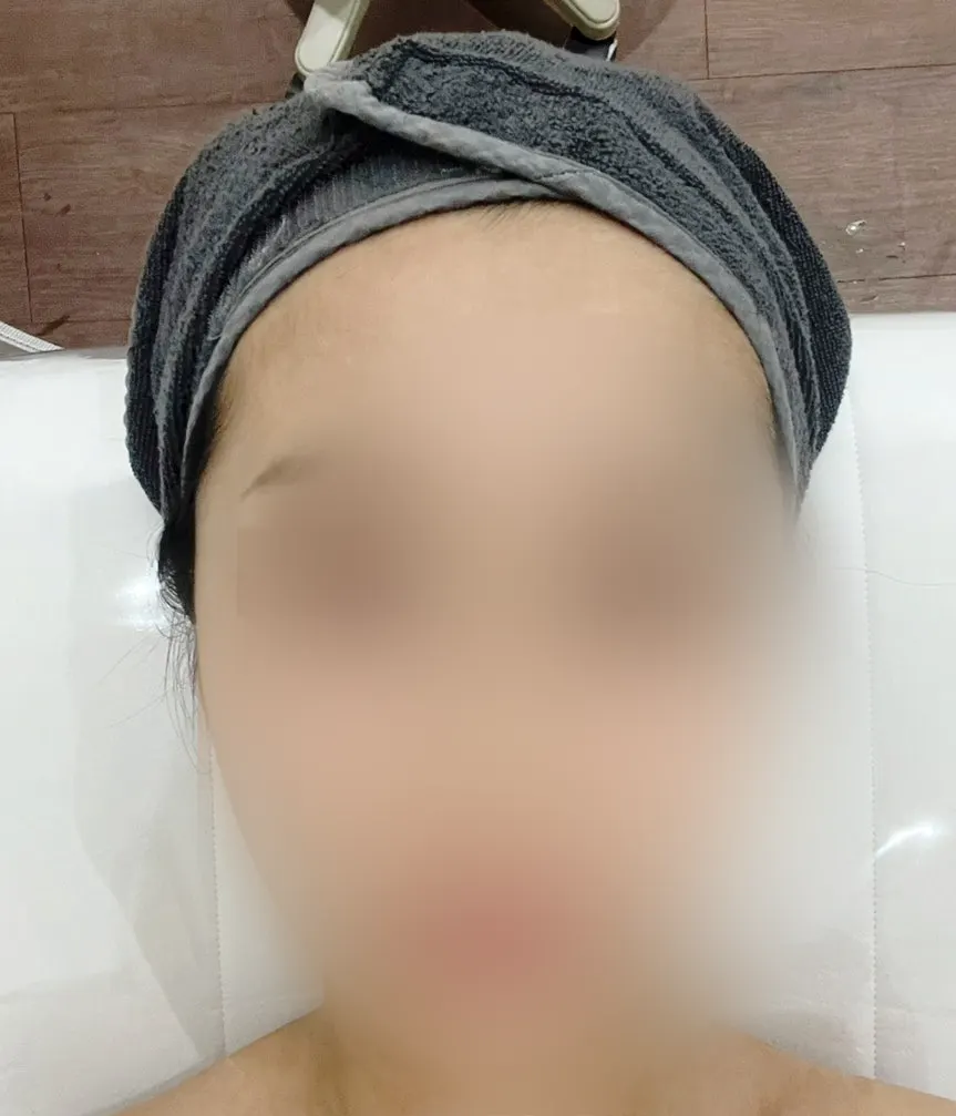 Bare face before the 3D facial contour care