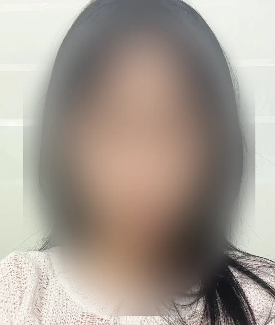 Checking facial swelling changes in the mirror during treatment