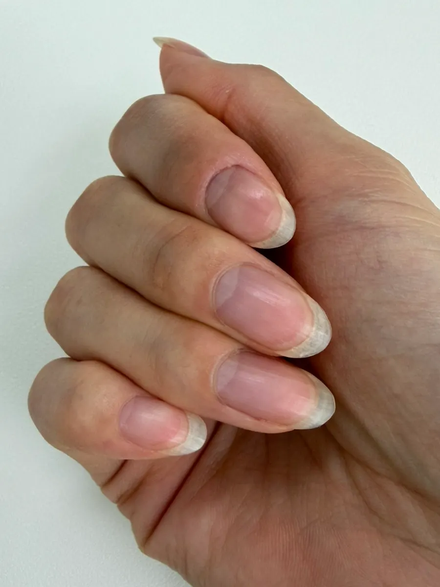 네일 전 손톱 상태 비포 사진