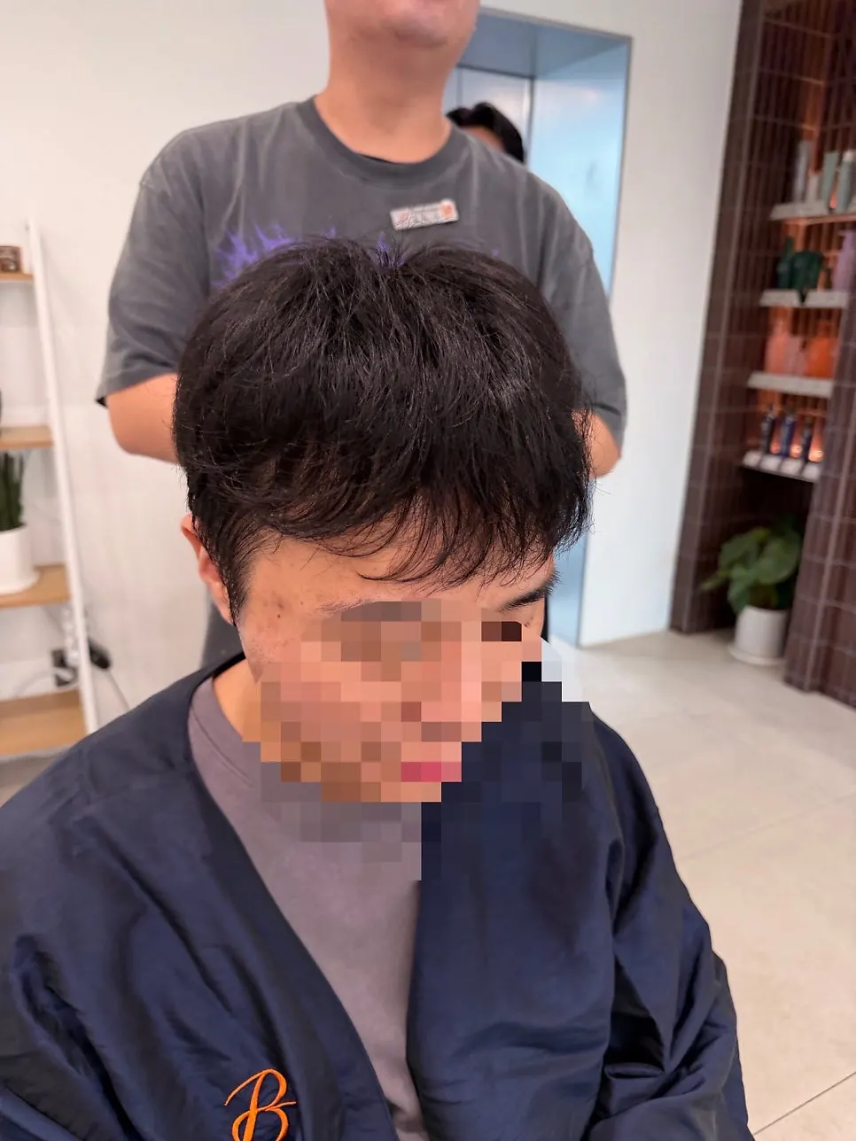 시술 전 남자 머리 측면 비포 컷