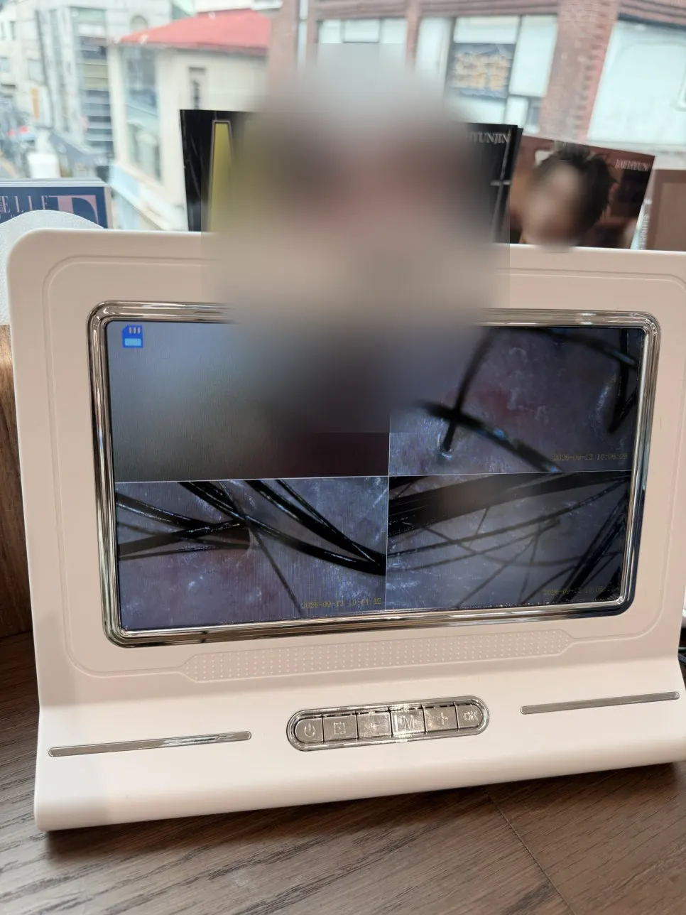 두피 스케일링 제품 도포 과정