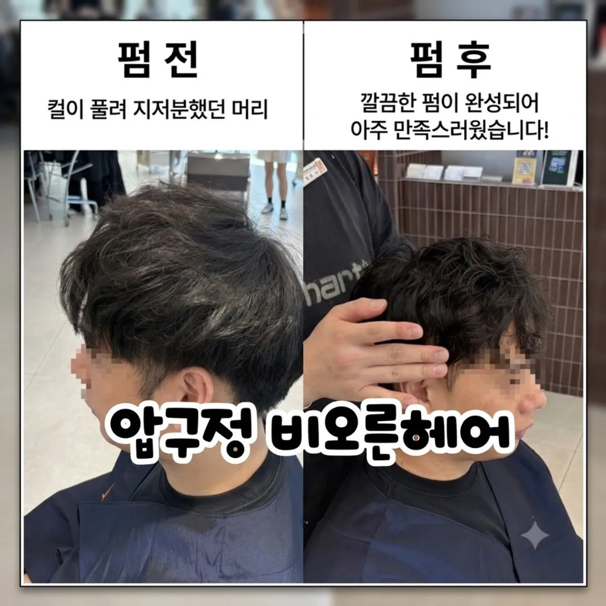 컬이 풀려 부스스해진 시술 전 남자 머리