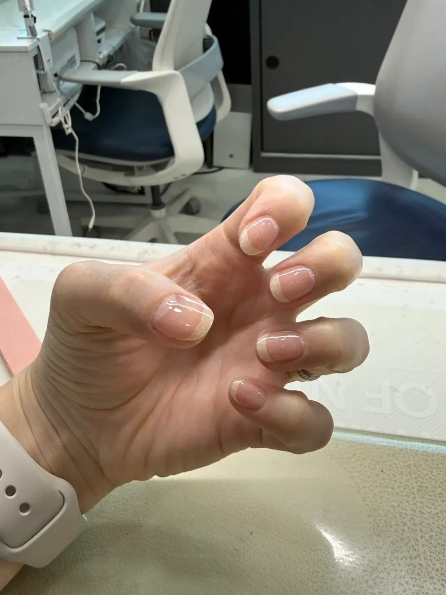 Nails after basic care was completed