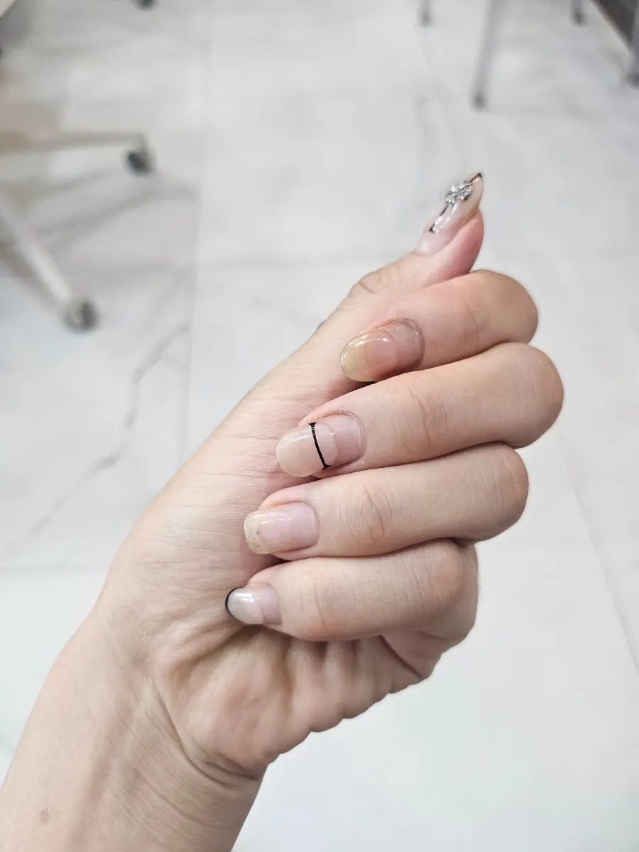 Nails before the service, grown out over a month
