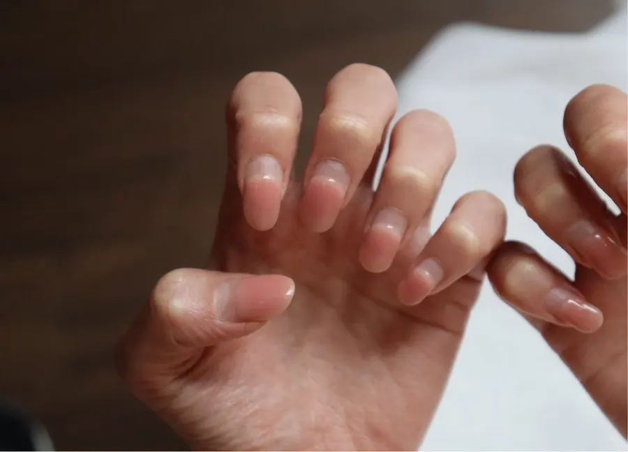 Overgrown nails and cuticle condition before the service