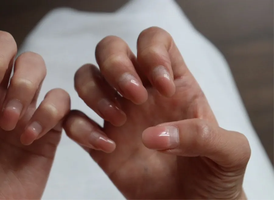 Close-up of nails in before condition