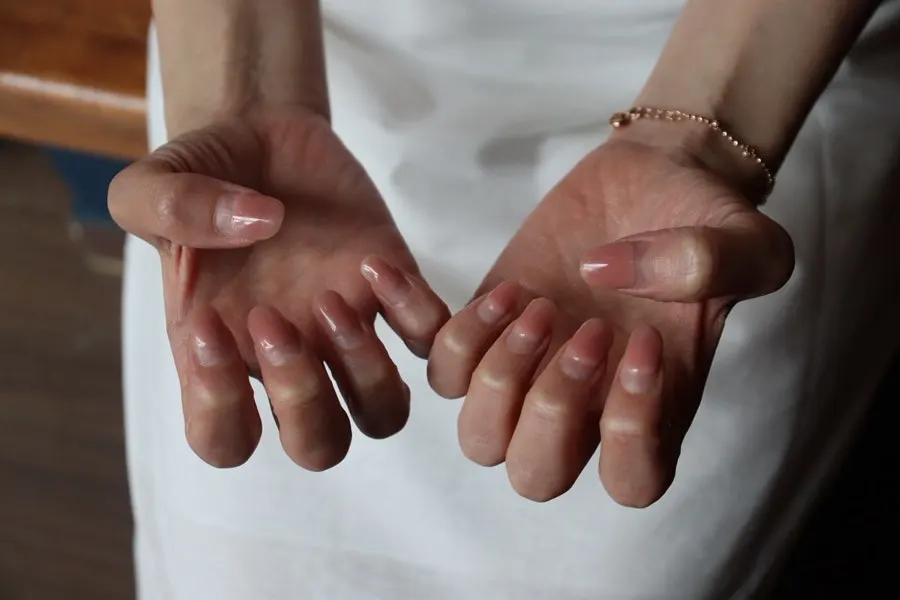 Cuticle condition around the nails before the service