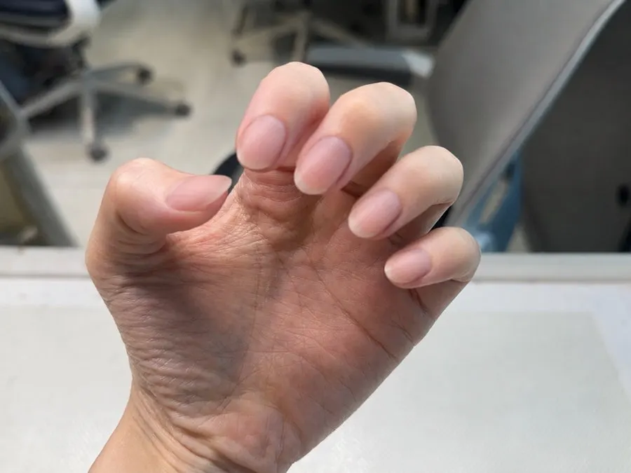 Area around the nails looking tidy after care