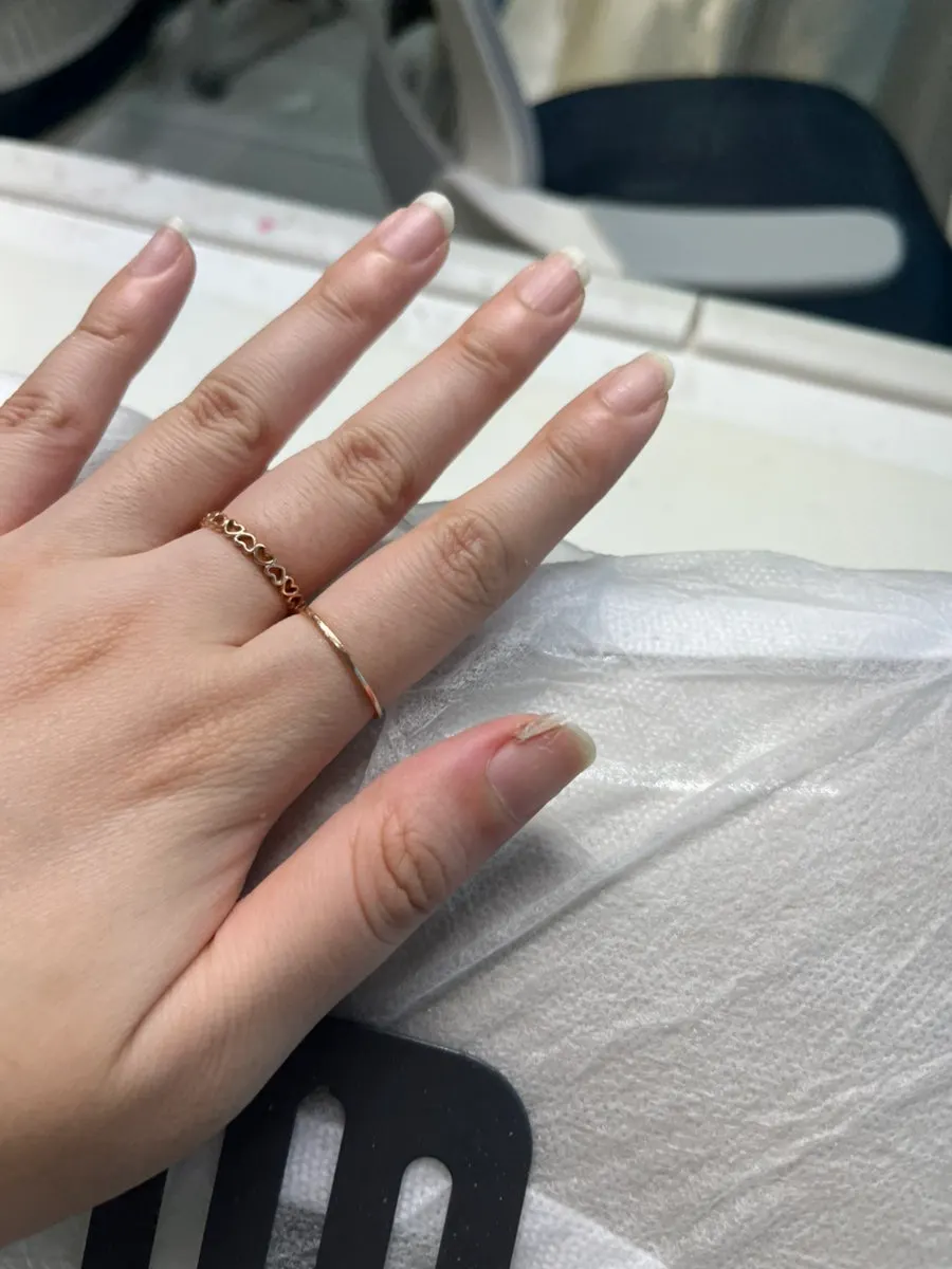 Nail condition before broken nail repair