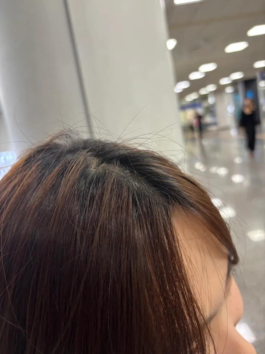 Root condition 3 months after the dye job