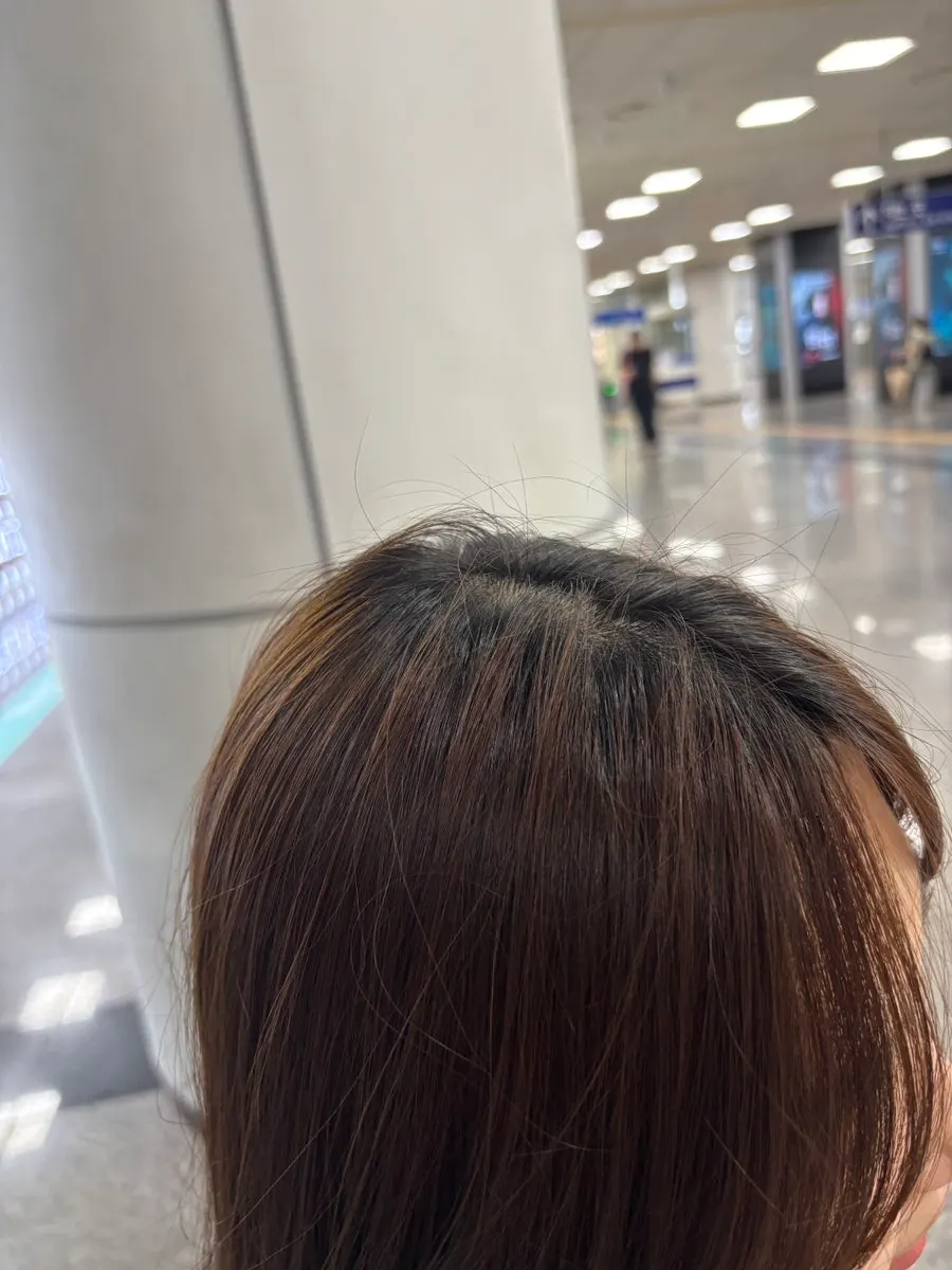 Root boundary after the Cooper Brown dye