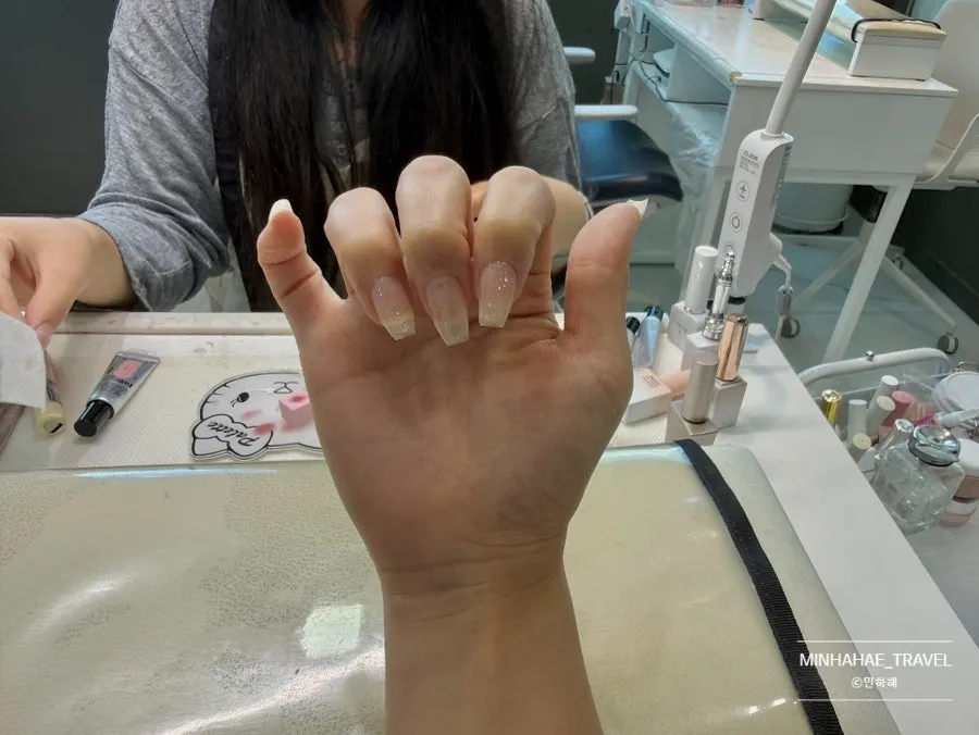 자석젤 시술 마무리 단계