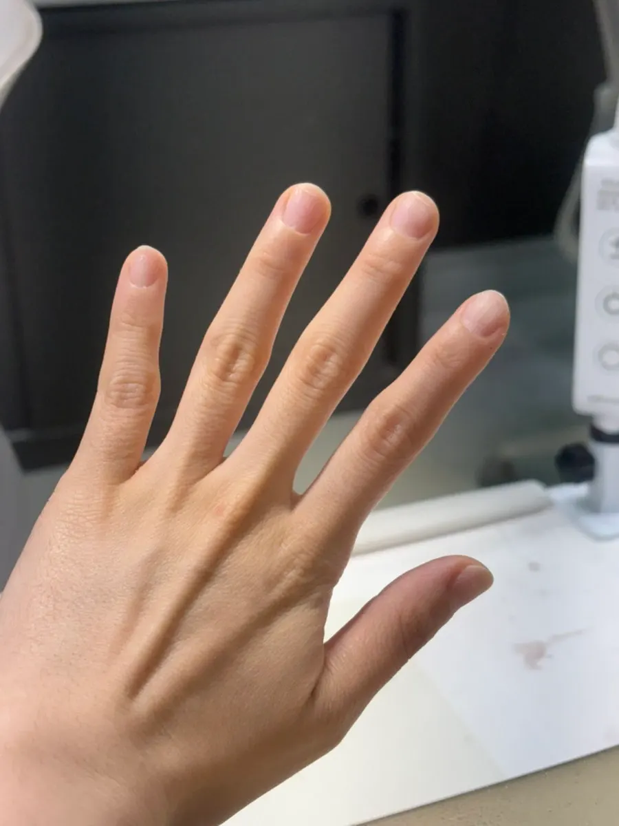 Nails tidied up after care