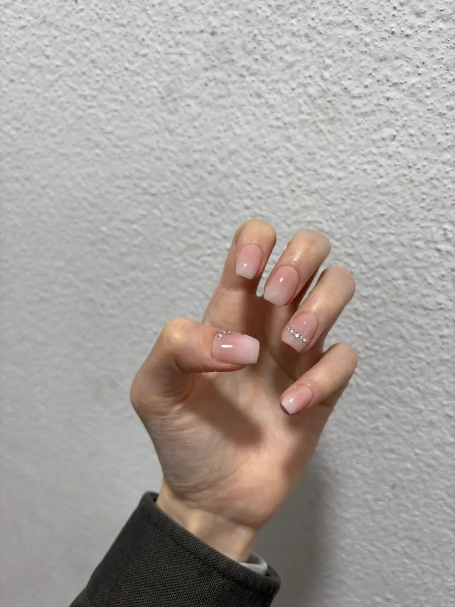 내일디디 시술 메뉴 안내판