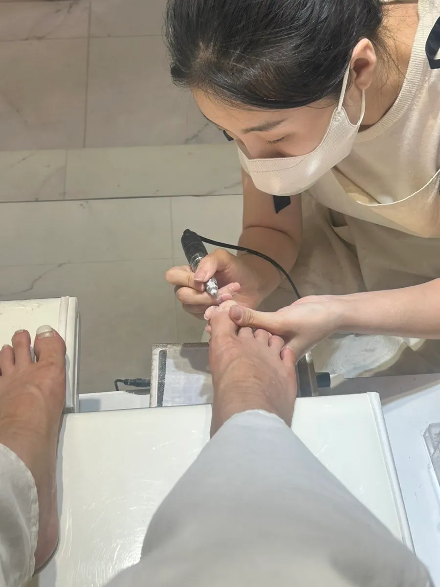 Photo of the old pedicure removal process