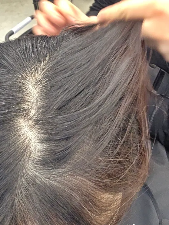 Checking hair condition before the treatment