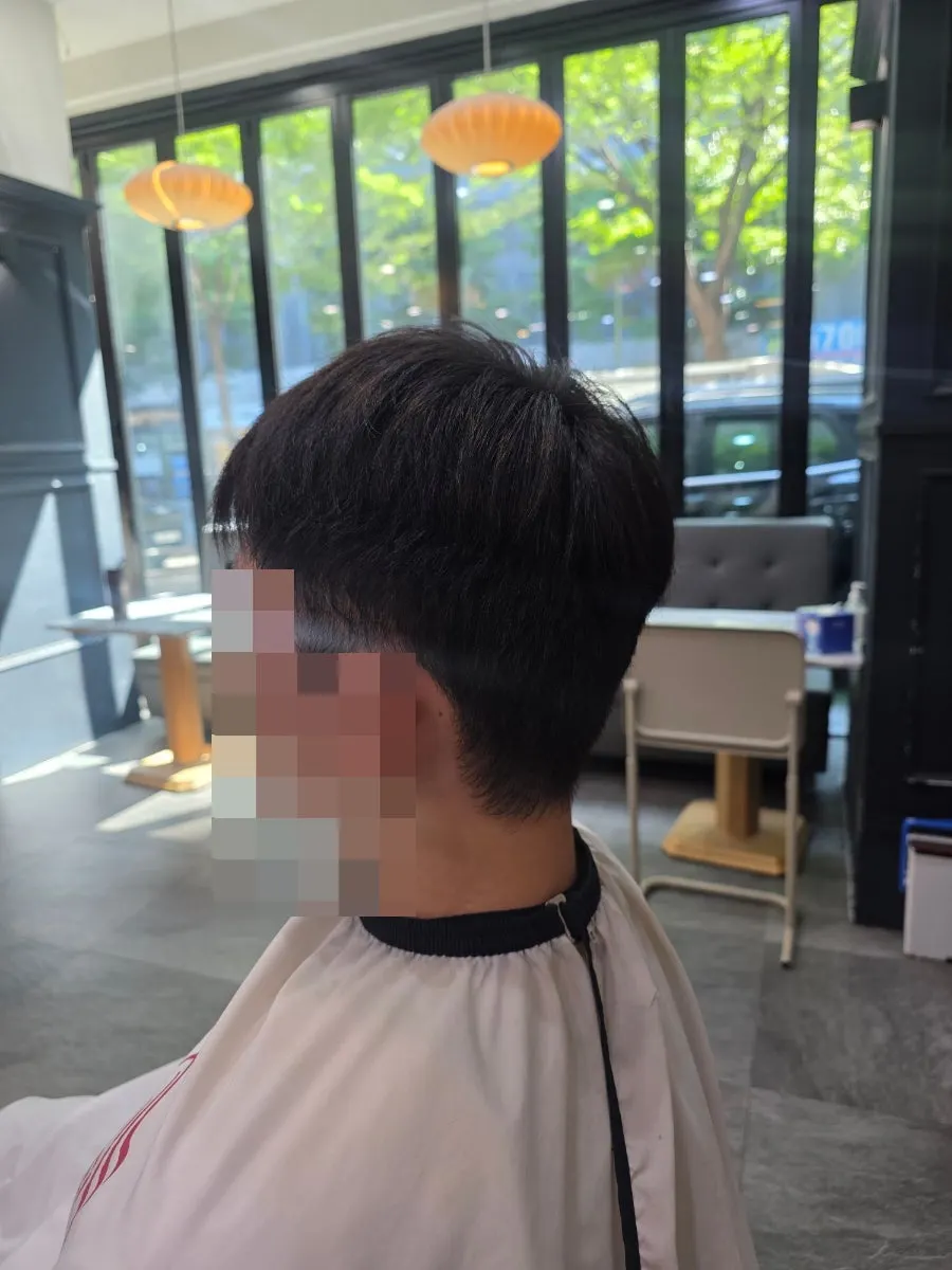 길이가 들쑥날쑥한 시술 전 머리