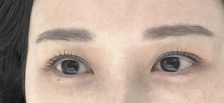 Before-and-after comparison of the lash lift