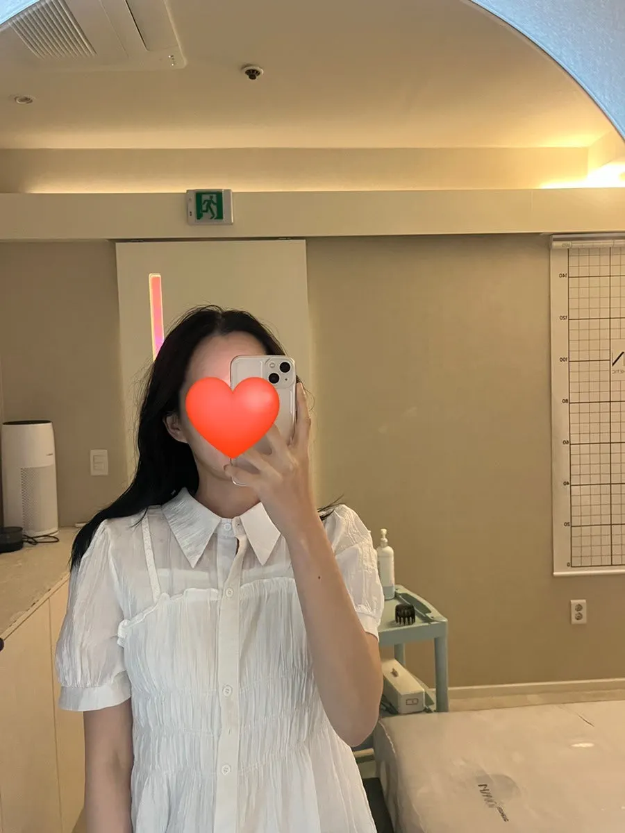 Jawline after the V-Fit contour treatment