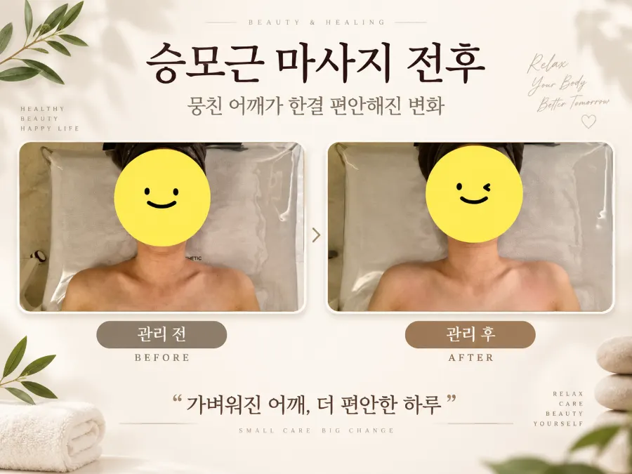VT 슬리밍 승모근 복부 관리 후 모습