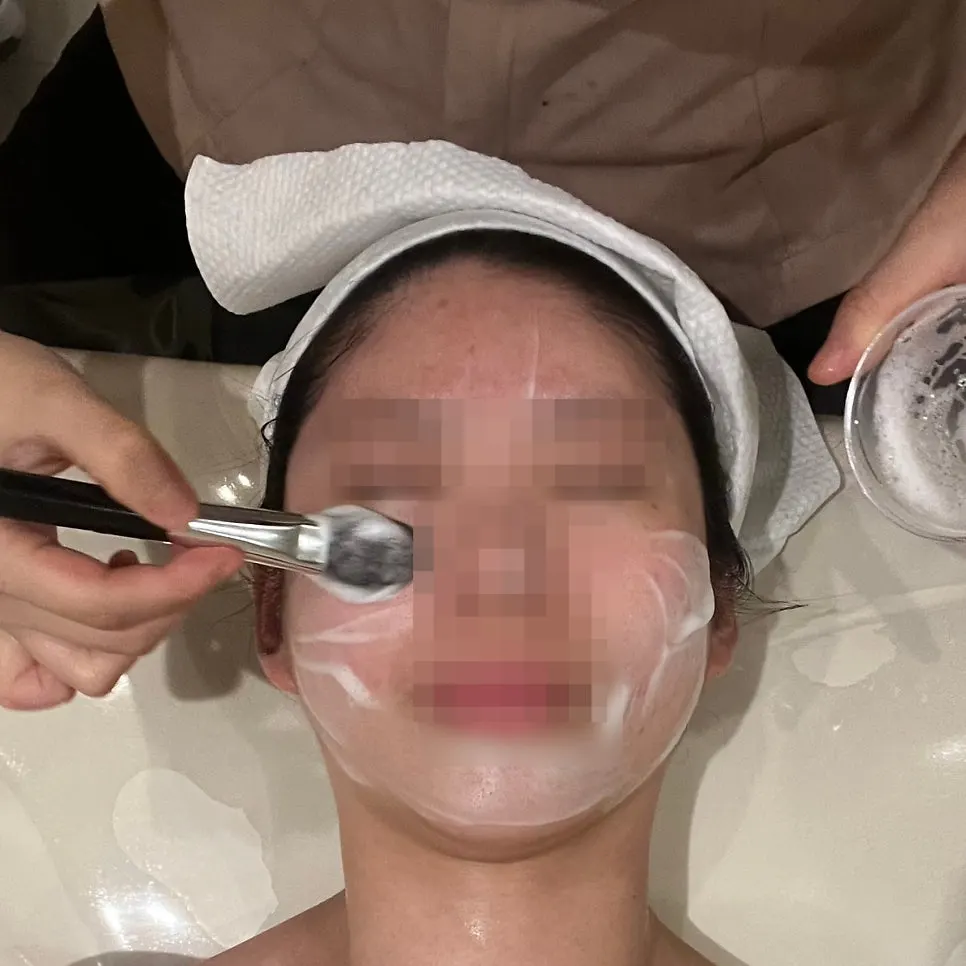 Cleansing step of the treatment