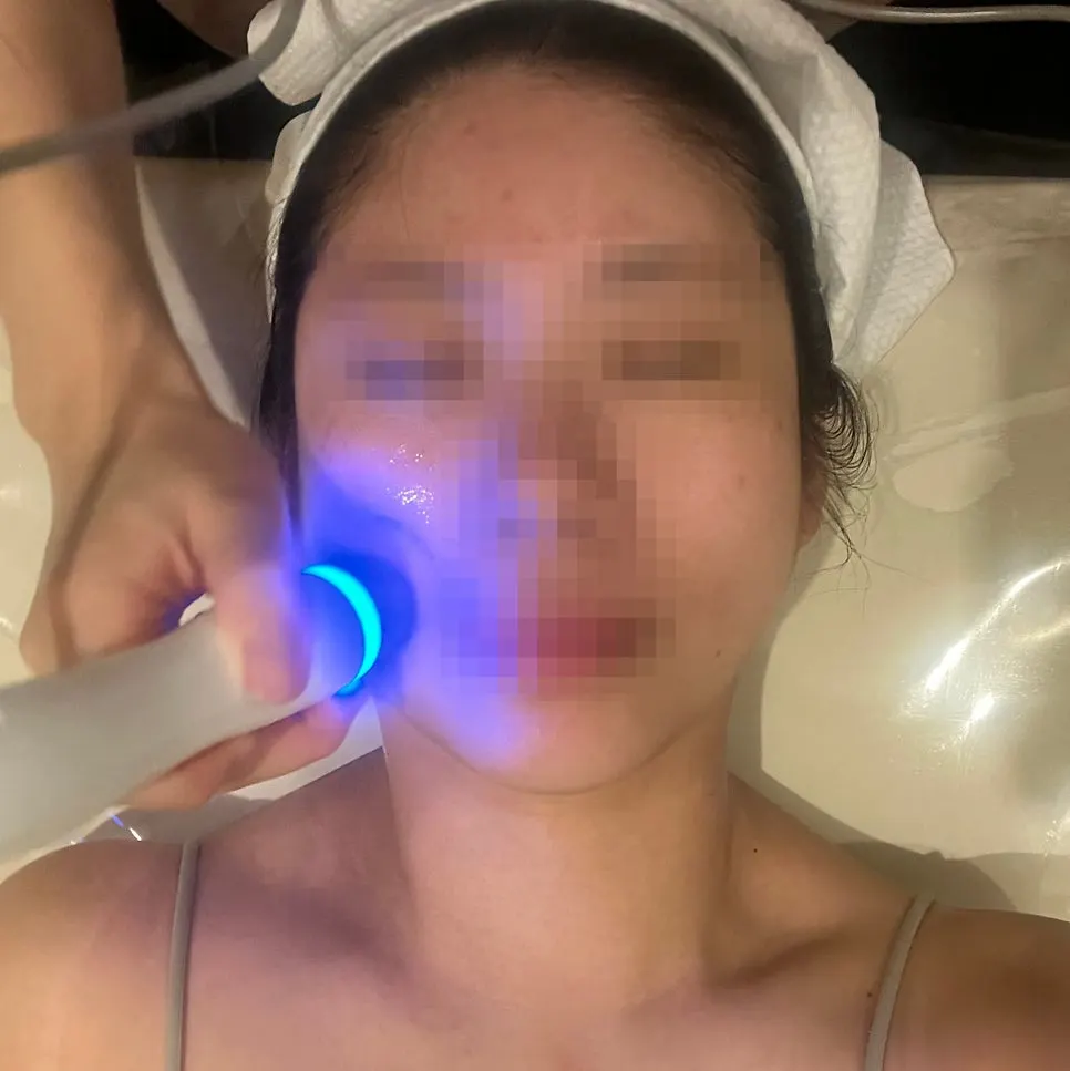 Blue Exosome ampoule