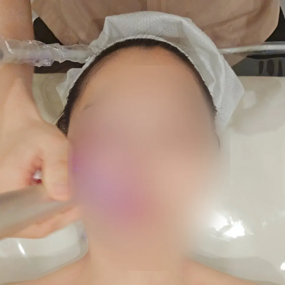Applying Exosome Blue 5ml and performing water-drop ultrasound treatment