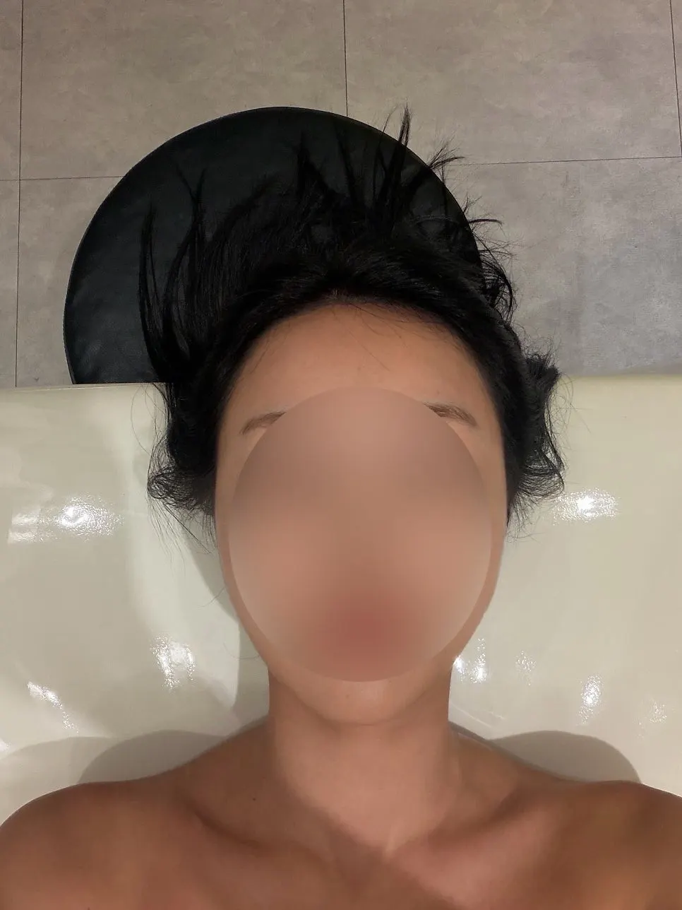 헤드앤넥 관리 전 얼굴 라인