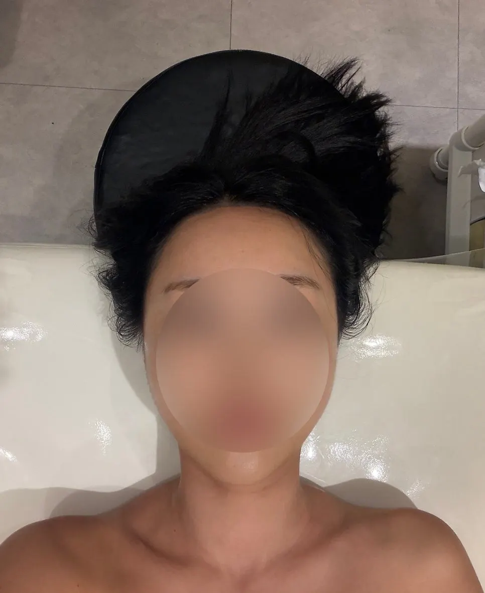 관리 후 붓기가 빠진 얼굴 라인
