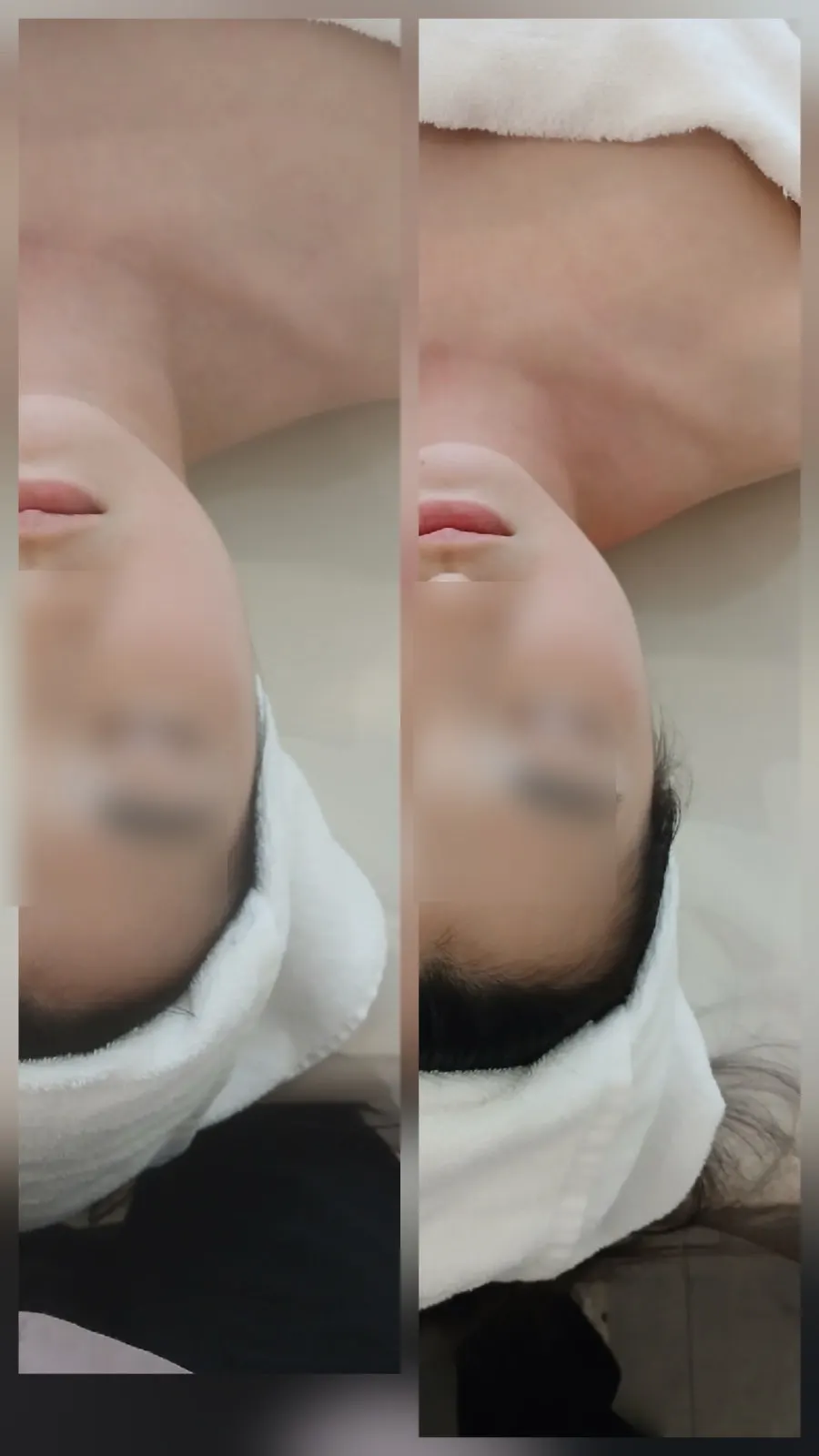 Scalp care performed with a scalp-specific device