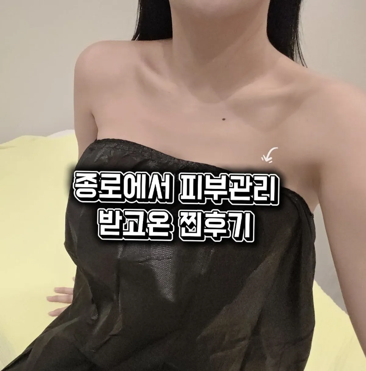 Jawline and neck condition before care