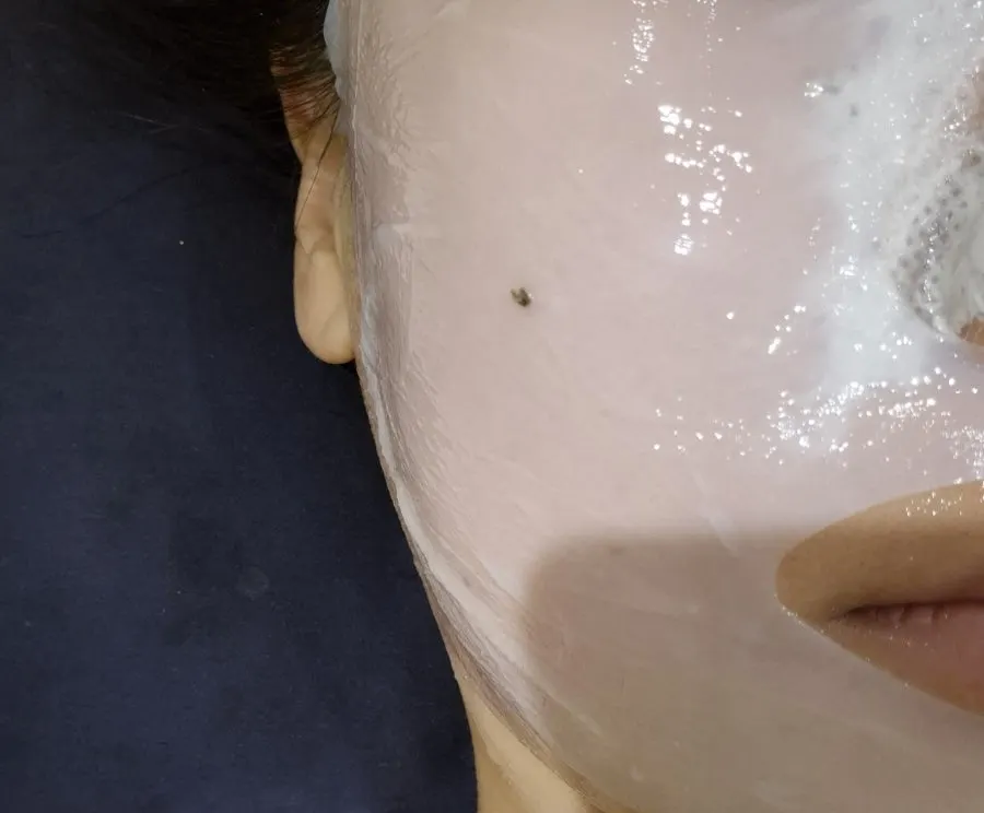 Calming pack on the face with a mud pack on the nose