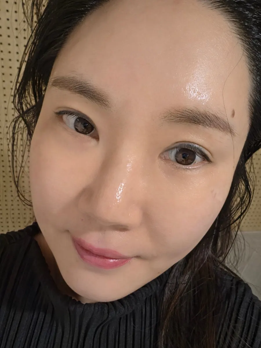 관리 후 정리된 턱 라인과 화사해진 안색