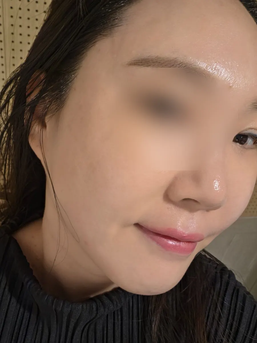 관리를 마친 뒤 촉촉해진 피부