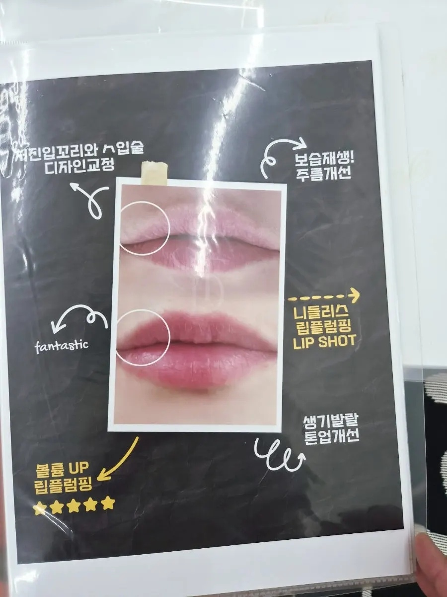 Guide to lip-plumping care at Doi Beauty