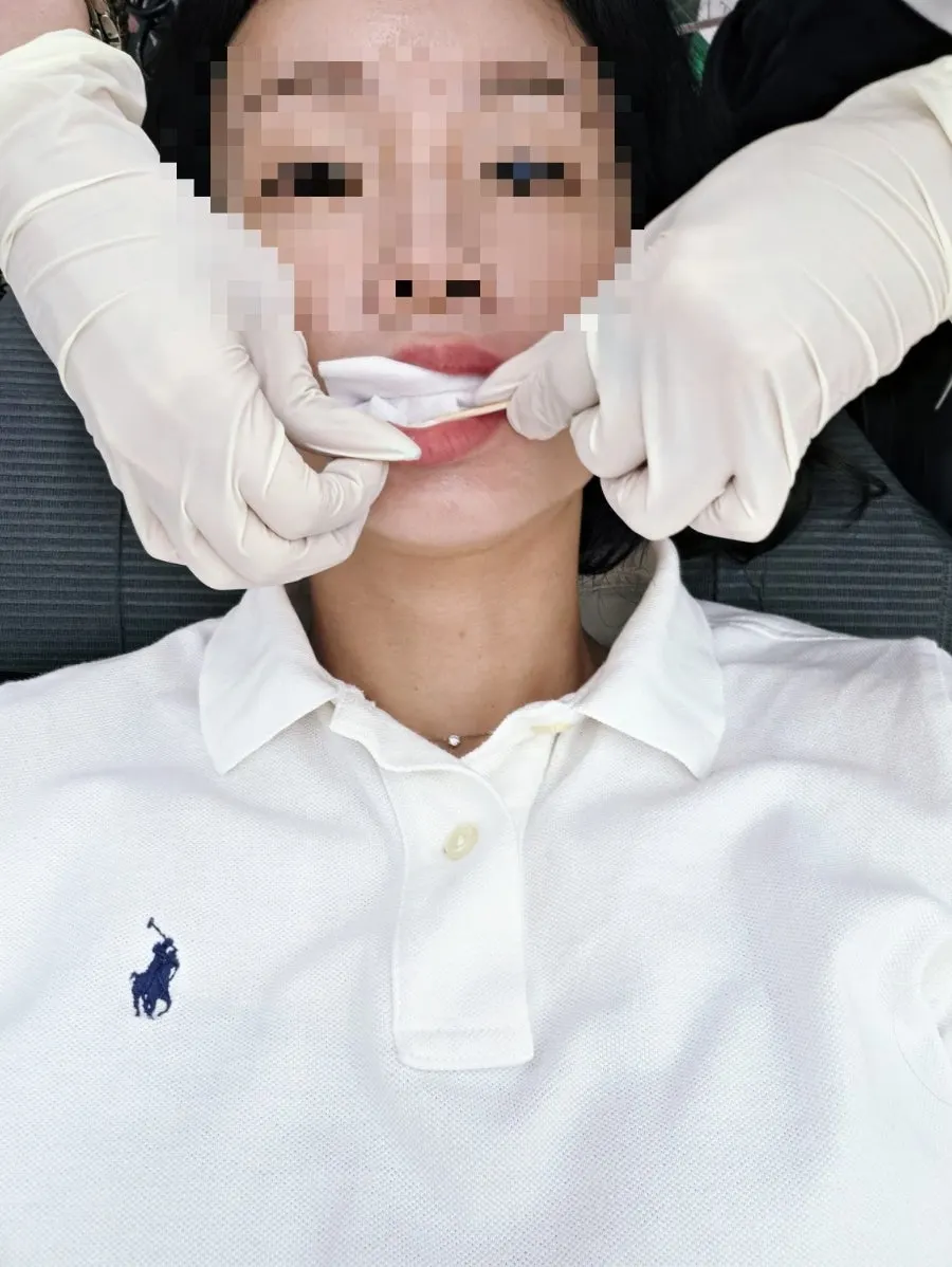 Preparing the high-concentration lip-plumping ampoule and air gun