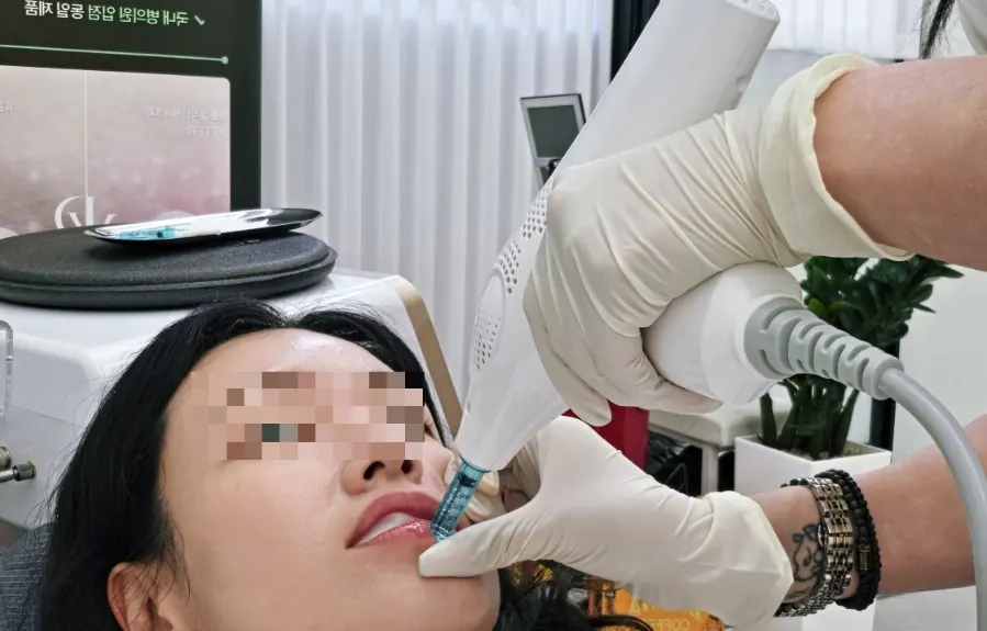 Preparing the high-concentration lip-plumping ampoule and air gun