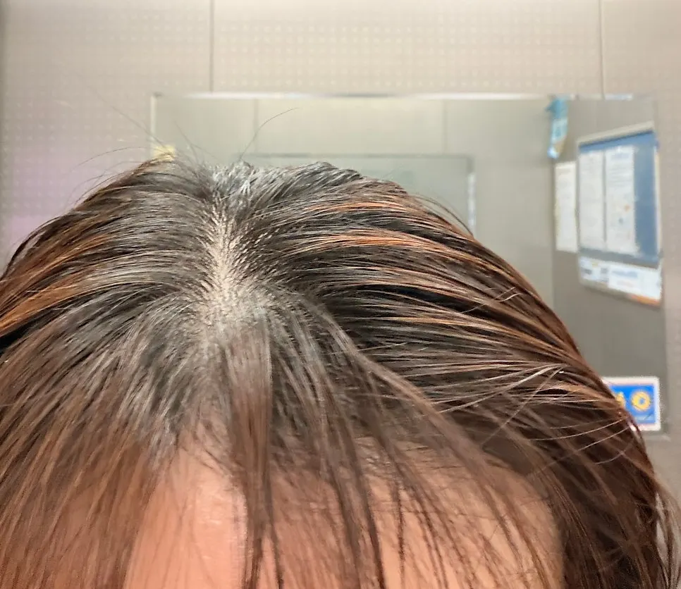 Hair before dyeing, faded with black roots showing