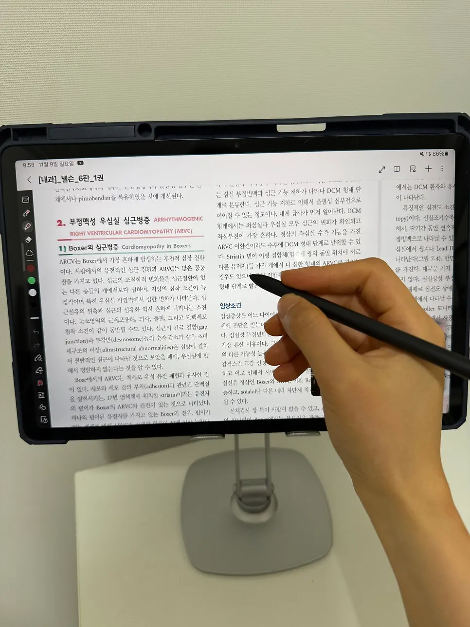 각도 조절 태블릿 거치대 사용 모습